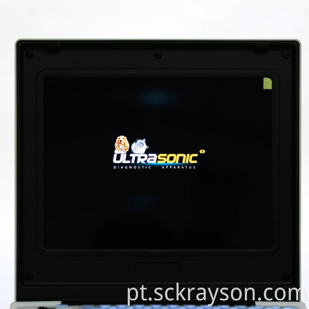 Laptop Ultrasound Screen